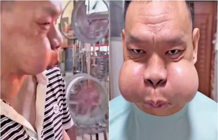 content_image_a60ce39b-6f68-404b-9117-6186f75ad50e (1)